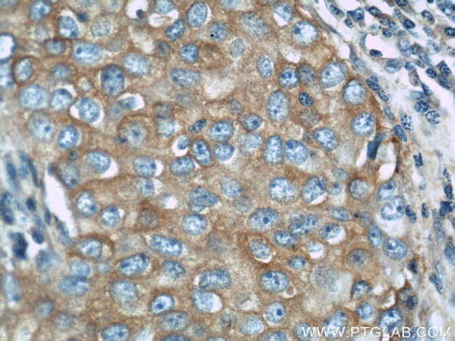 LGP2 Antibody in Immunohistochemistry (Paraffin) (IHC (P))