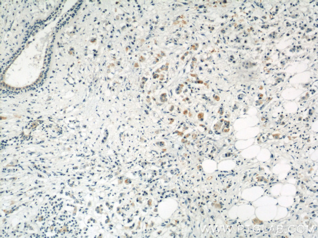 LGP2 Antibody in Immunohistochemistry (Paraffin) (IHC (P))