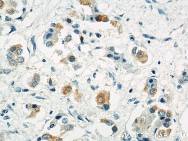 LGP2 Antibody in Immunohistochemistry (Paraffin) (IHC (P))