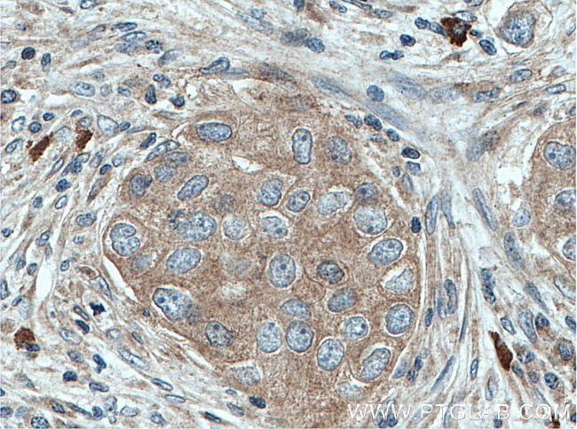 LGP2 Antibody in Immunohistochemistry (Paraffin) (IHC (P))