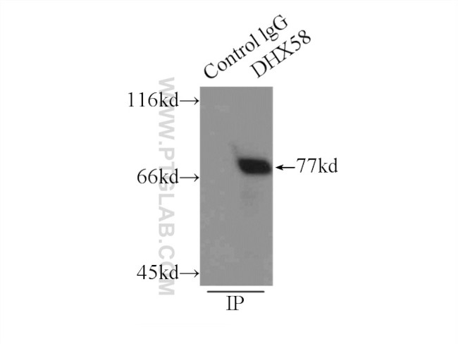 LGP2 Antibody in Immunoprecipitation (IP)