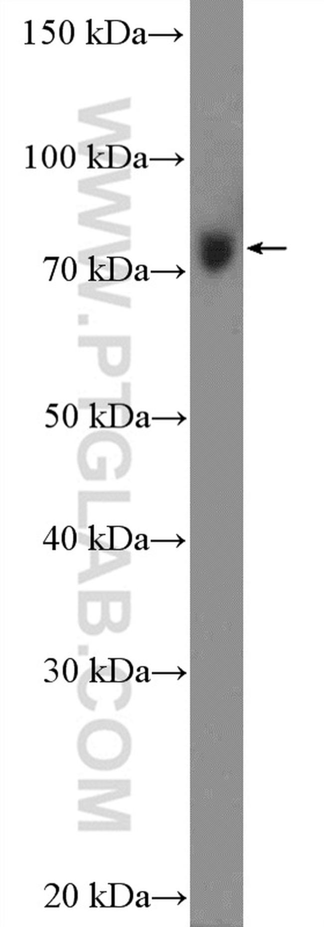 LGP2 Antibody in Western Blot (WB)