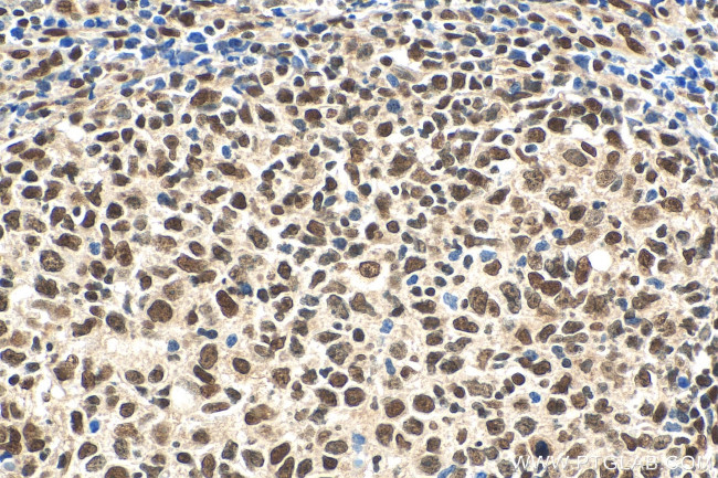 DDX1 Antibody in Immunohistochemistry (Paraffin) (IHC (P))