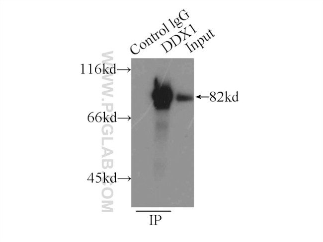 DDX1 Antibody in Immunoprecipitation (IP)