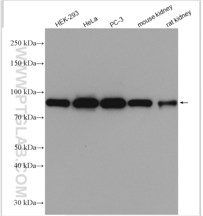 DDX1 Antibody in Western Blot (WB)