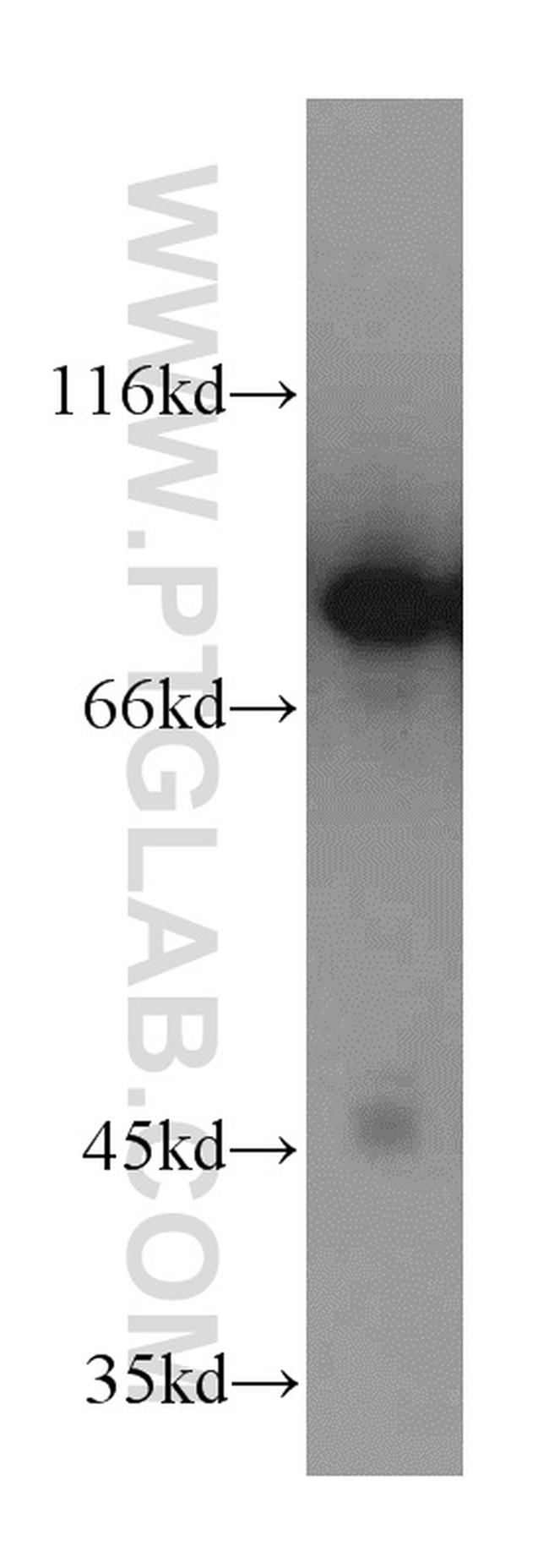 DDX1 Antibody in Western Blot (WB)