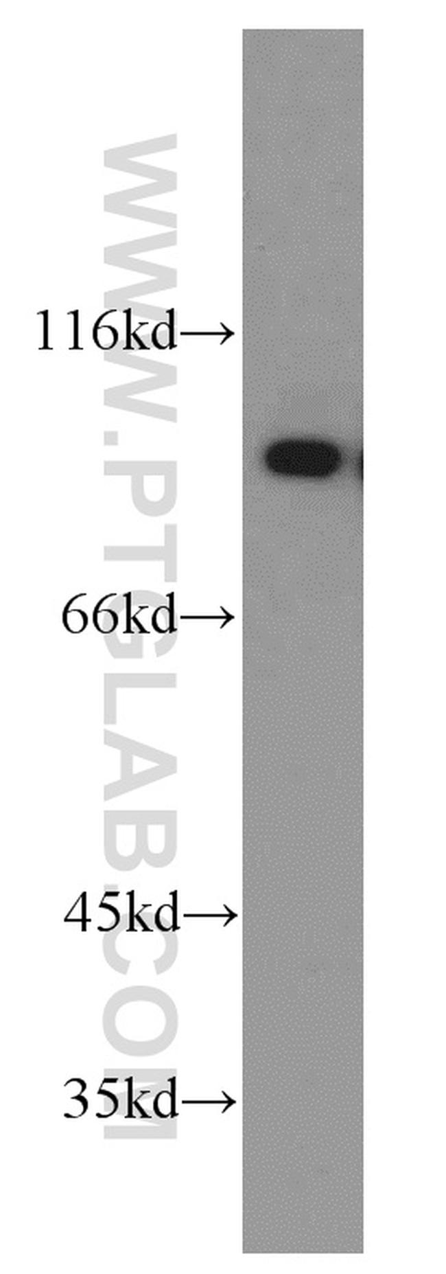 DDX1 Antibody in Western Blot (WB)