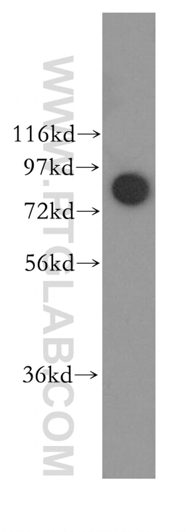 DDX1 Antibody in Western Blot (WB)