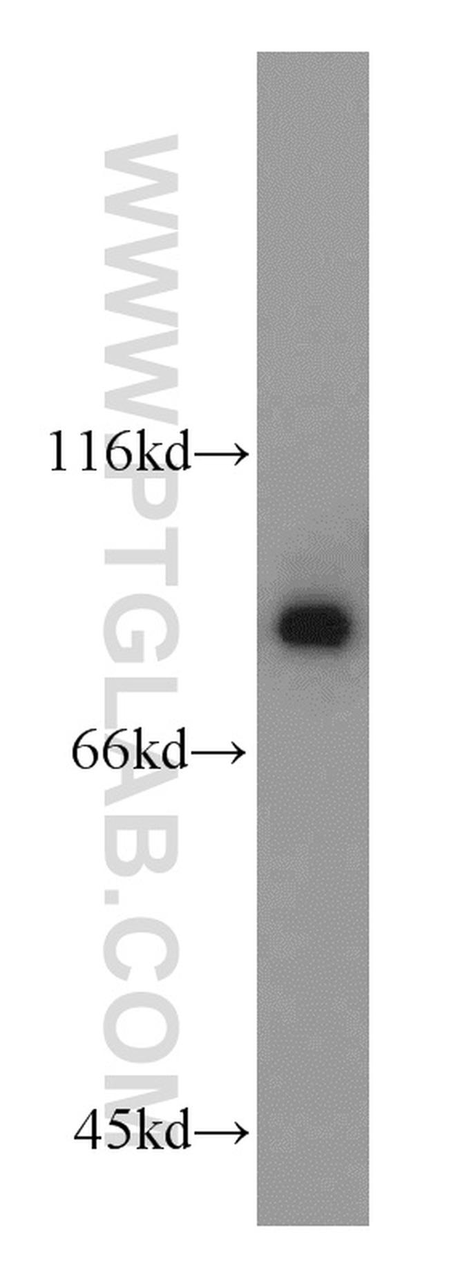 DDX1 Antibody in Western Blot (WB)