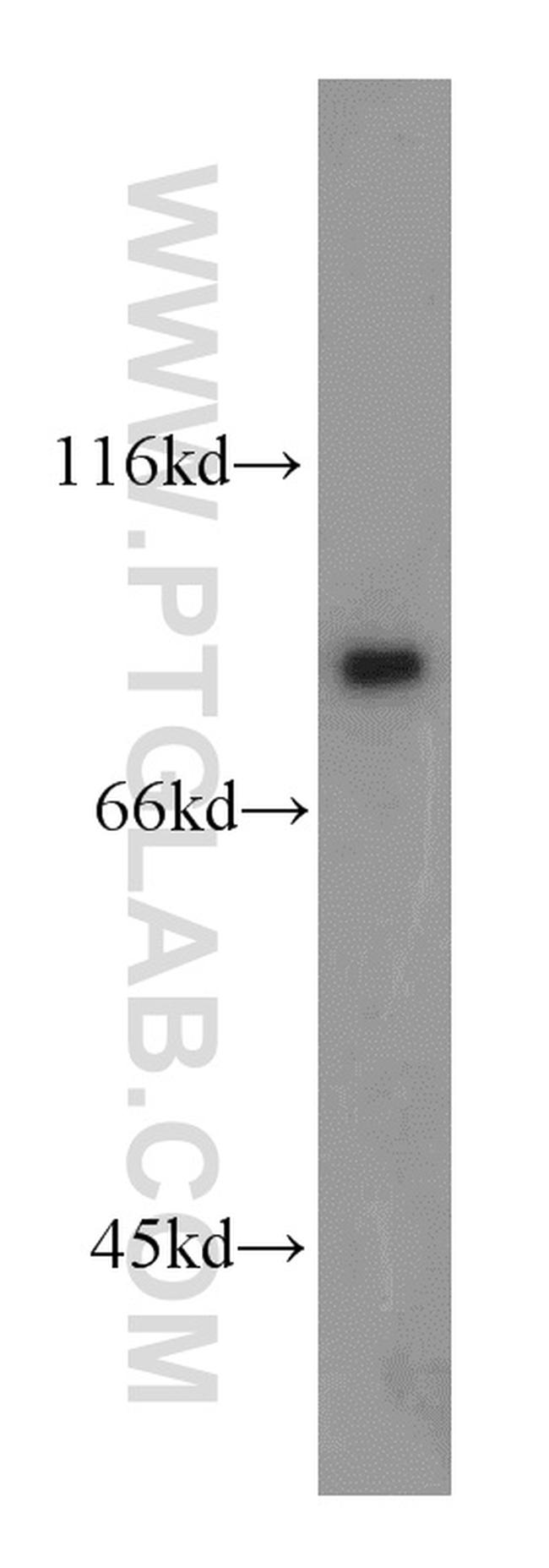 DDX1 Antibody in Western Blot (WB)