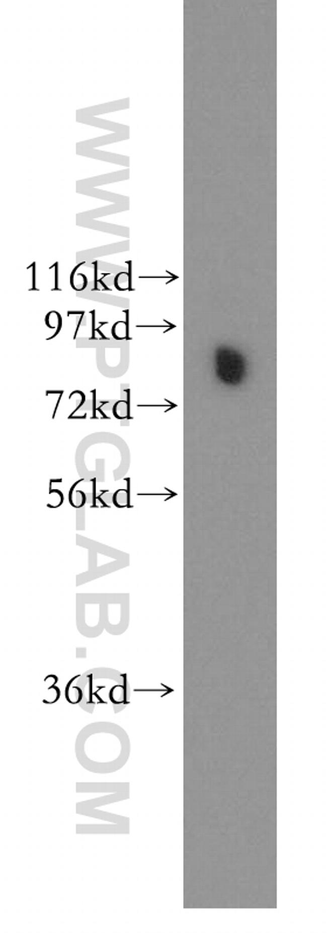 DDX1 Antibody in Western Blot (WB)