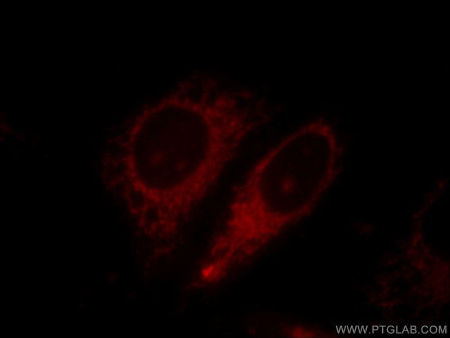 Harmonin Antibody in Immunocytochemistry (ICC/IF)