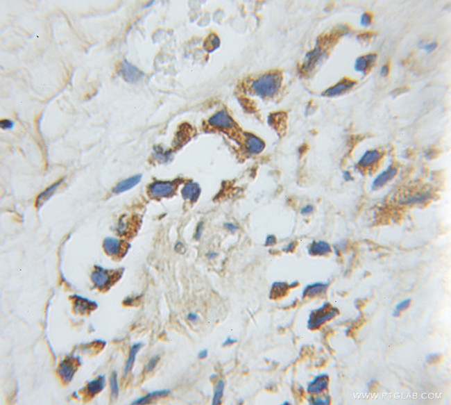 Harmonin Antibody in Immunohistochemistry (Paraffin) (IHC (P))