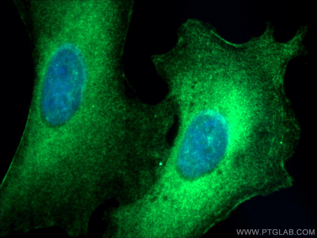 ARHGEF1 Antibody in Immunocytochemistry (ICC/IF)