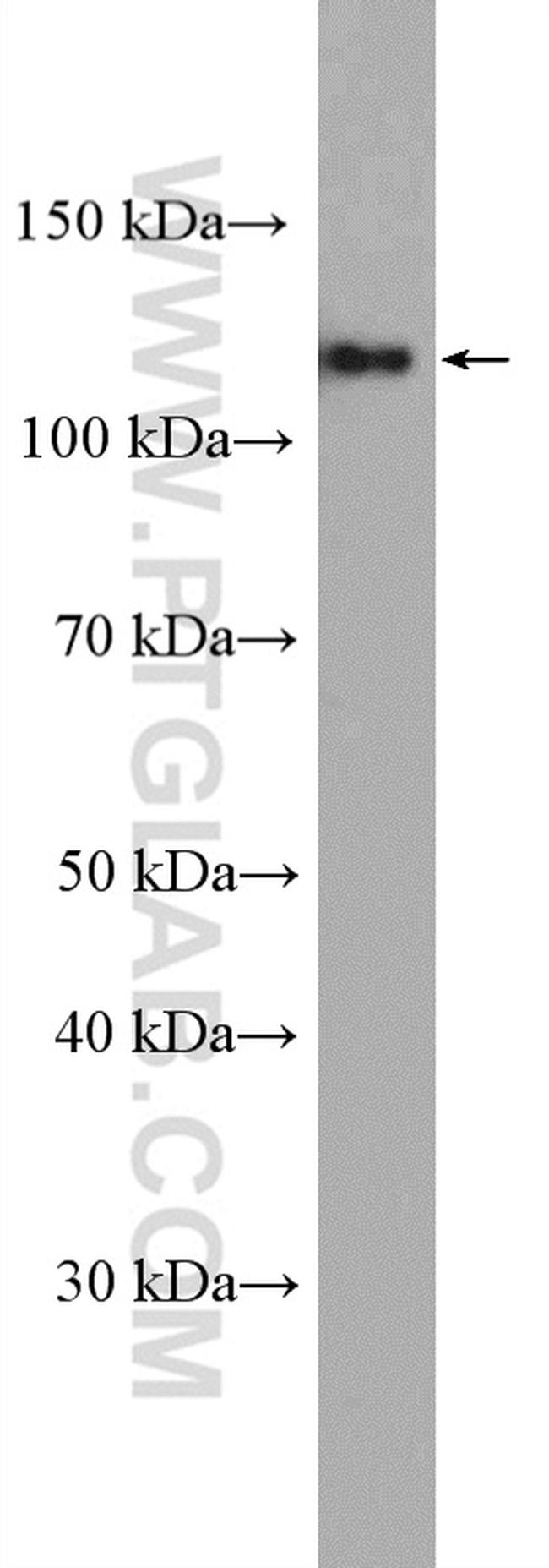 ARHGEF1 Antibody in Western Blot (WB)