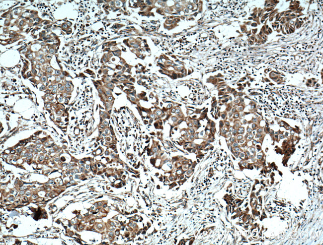 NCKIPSD Antibody in Immunohistochemistry (Paraffin) (IHC (P))