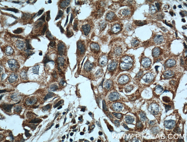 NCKIPSD Antibody in Immunohistochemistry (Paraffin) (IHC (P))