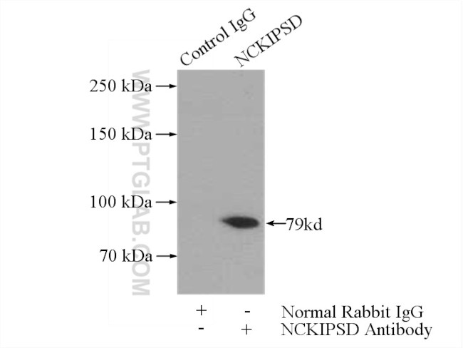 NCKIPSD Antibody in Immunoprecipitation (IP)