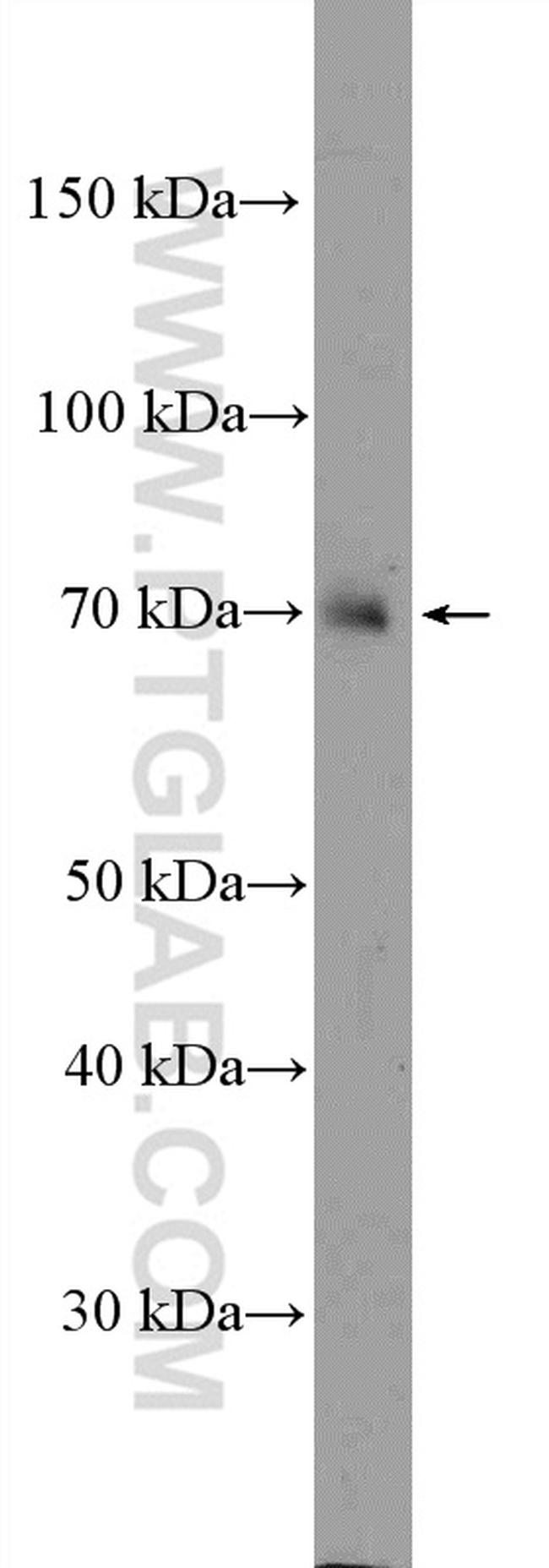 NCKIPSD Antibody in Western Blot (WB)