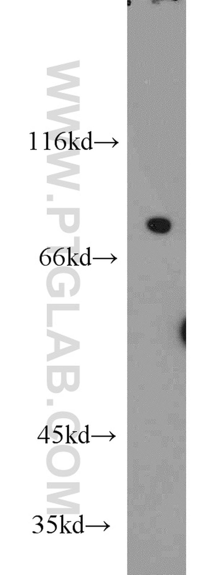 NCKIPSD Antibody in Western Blot (WB)