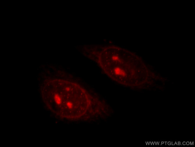 TIN2 Antibody in Immunocytochemistry (ICC/IF)