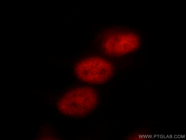 TLE3 Antibody in Immunocytochemistry (ICC/IF)