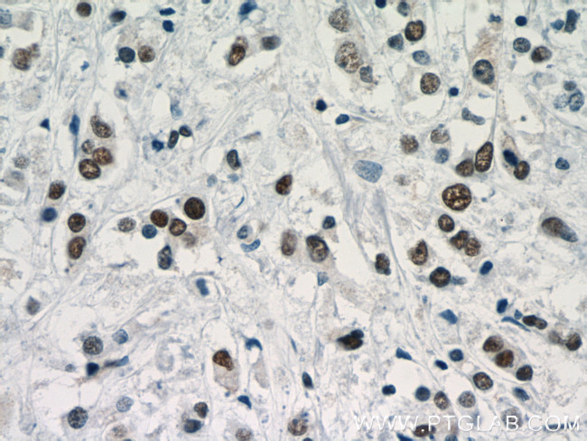 TLE3 Antibody in Immunohistochemistry (Paraffin) (IHC (P))