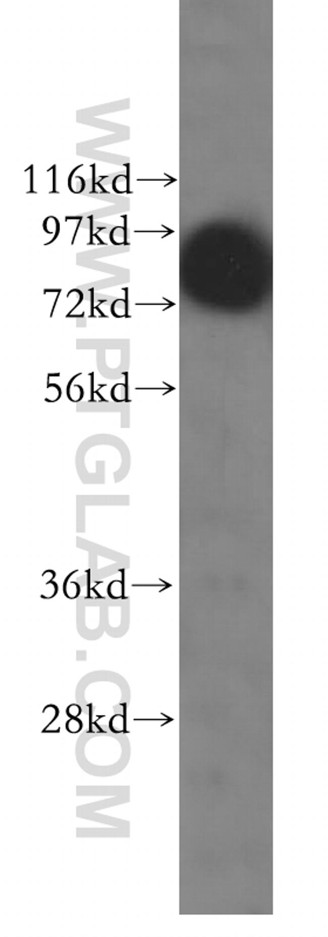 TLE3 Antibody in Western Blot (WB)