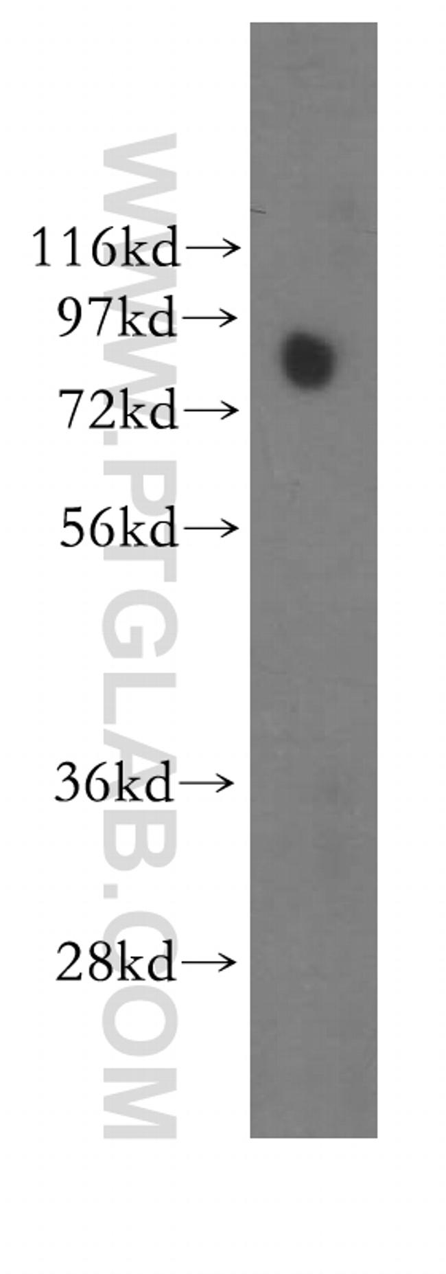 TLE3 Antibody in Western Blot (WB)