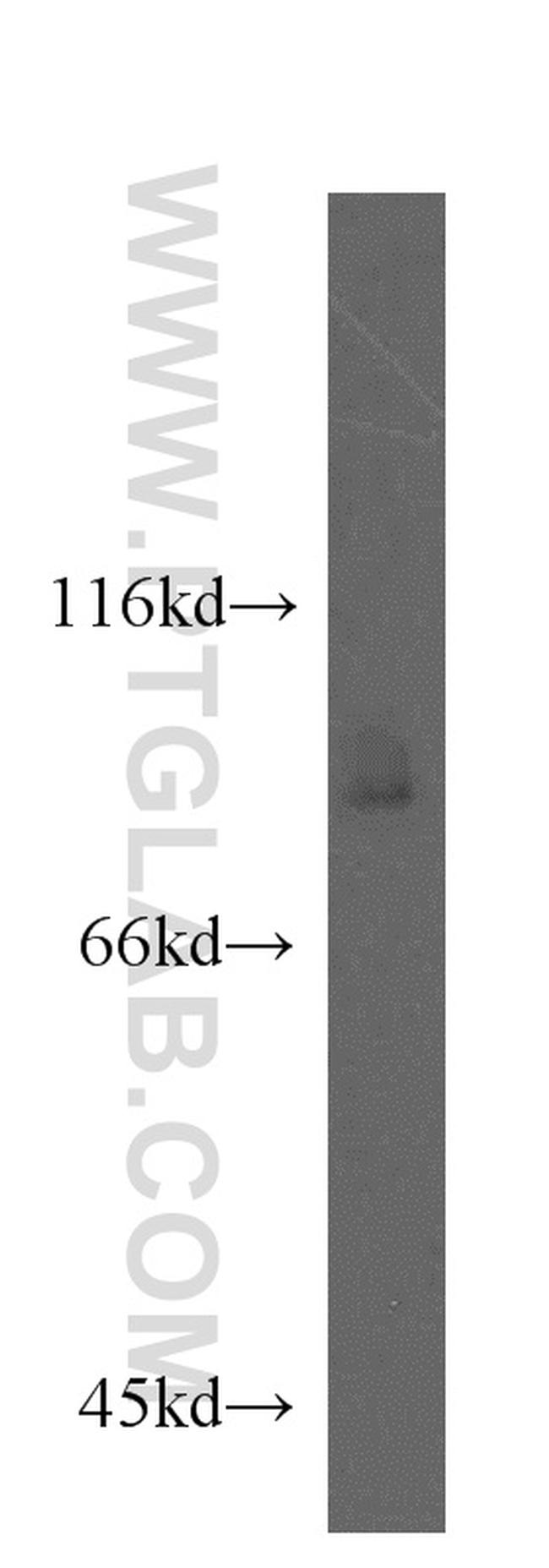 TLE3 Antibody in Western Blot (WB)