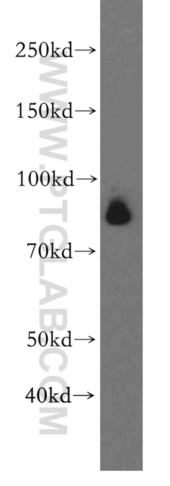 TLE3 Antibody in Western Blot (WB)