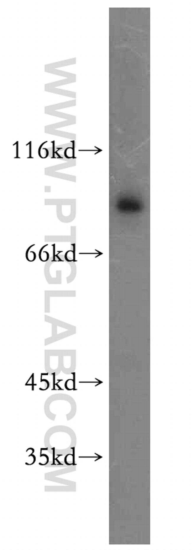 TLE3 Antibody in Western Blot (WB)