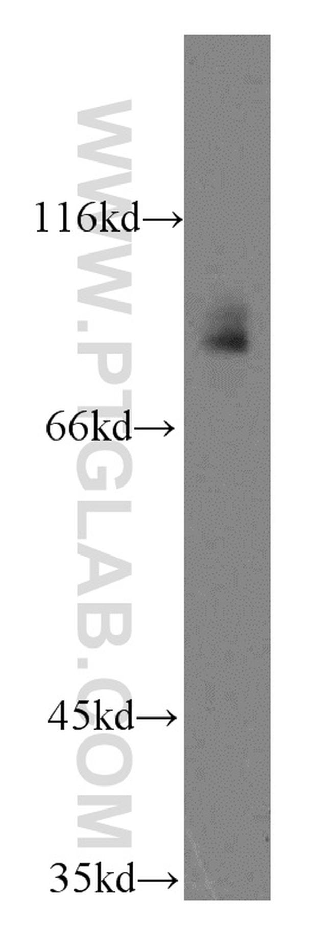 TLE3 Antibody in Western Blot (WB)