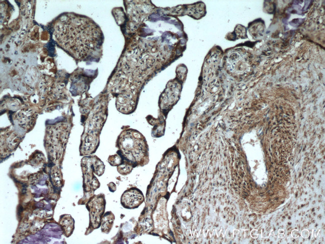 FH Antibody in Immunohistochemistry (Paraffin) (IHC (P))