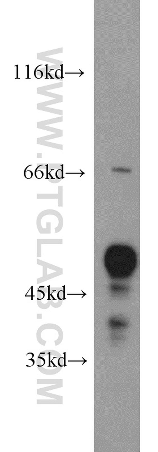 FH Antibody in Western Blot (WB)