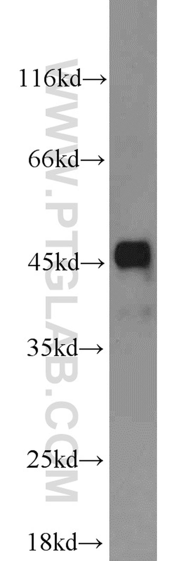 FH Antibody in Western Blot (WB)