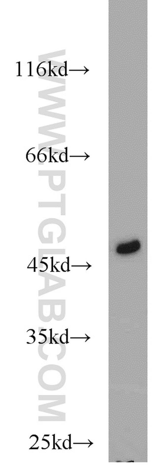 FH Antibody in Western Blot (WB)