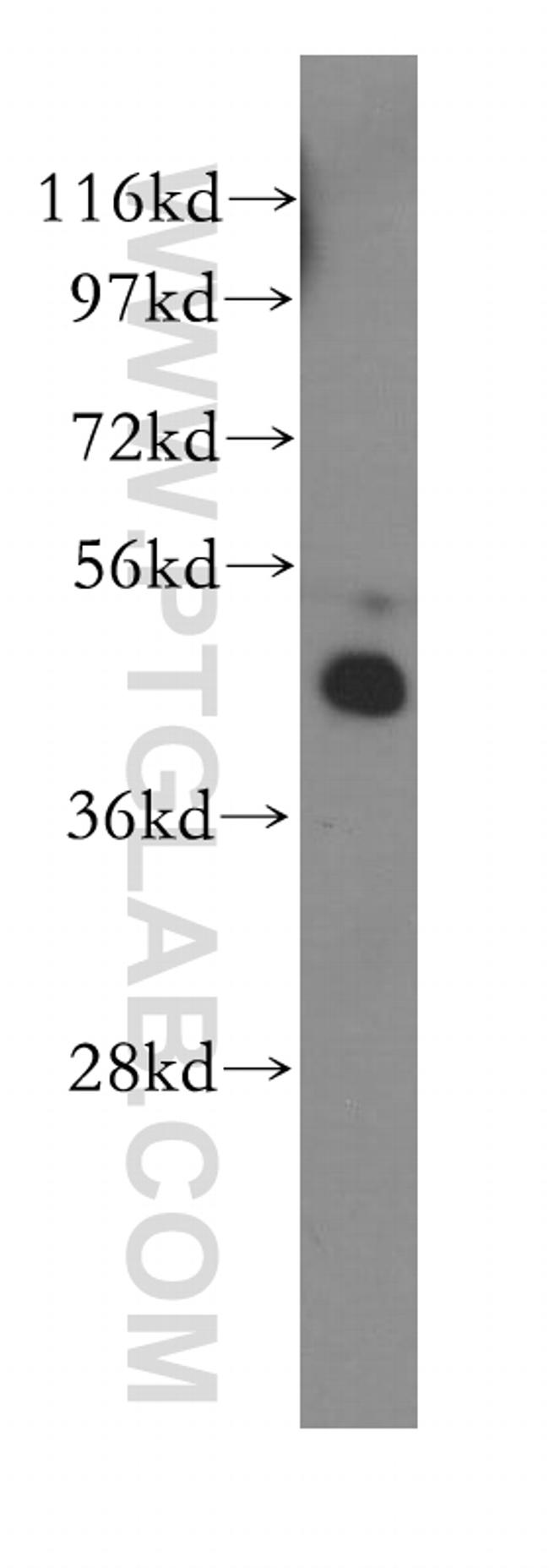 FH Antibody in Western Blot (WB)