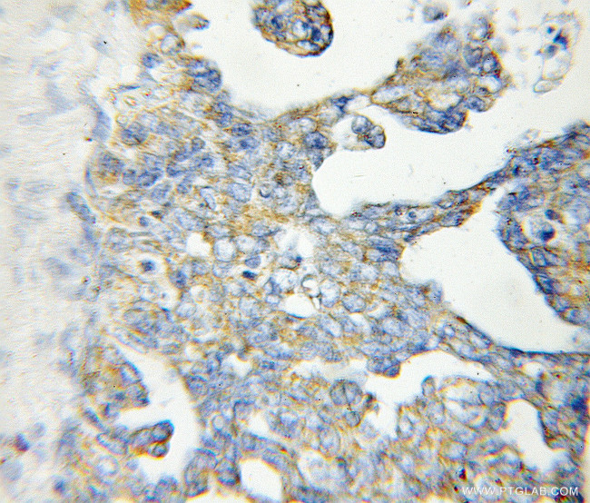 FH Antibody in Immunohistochemistry (Paraffin) (IHC (P))