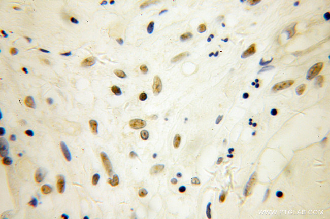 SP100 Antibody in Immunohistochemistry (Paraffin) (IHC (P))