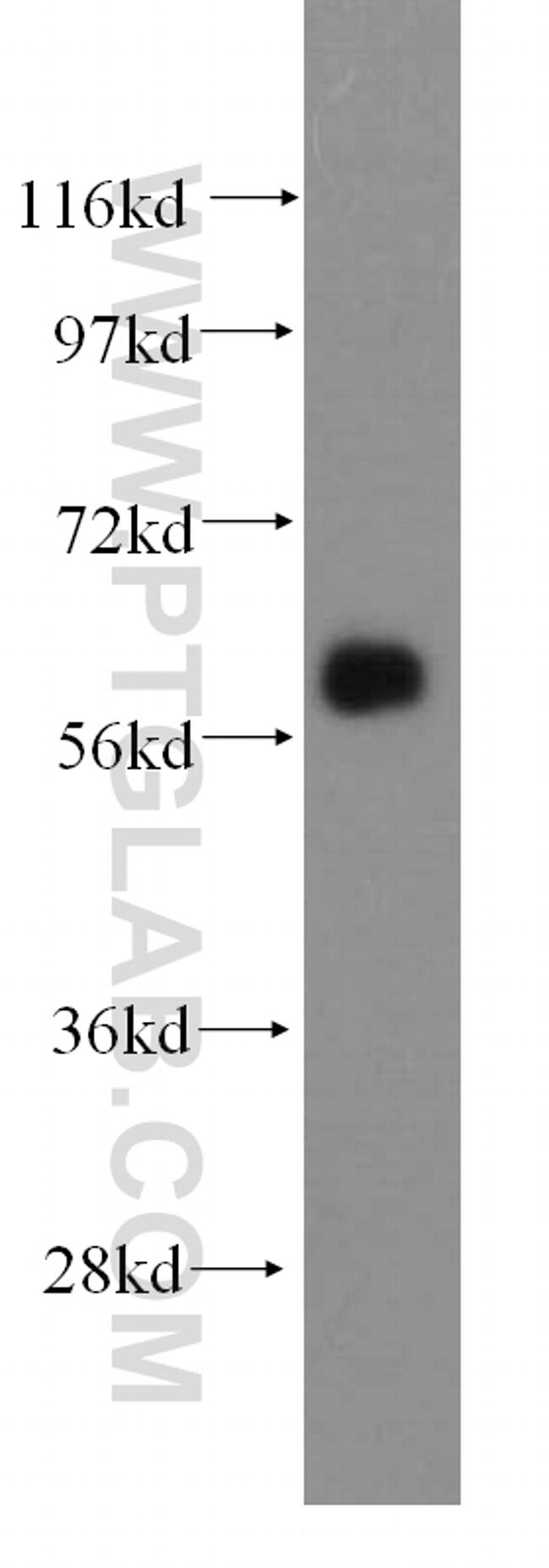 ARHGEF5 Antibody in Western Blot (WB)