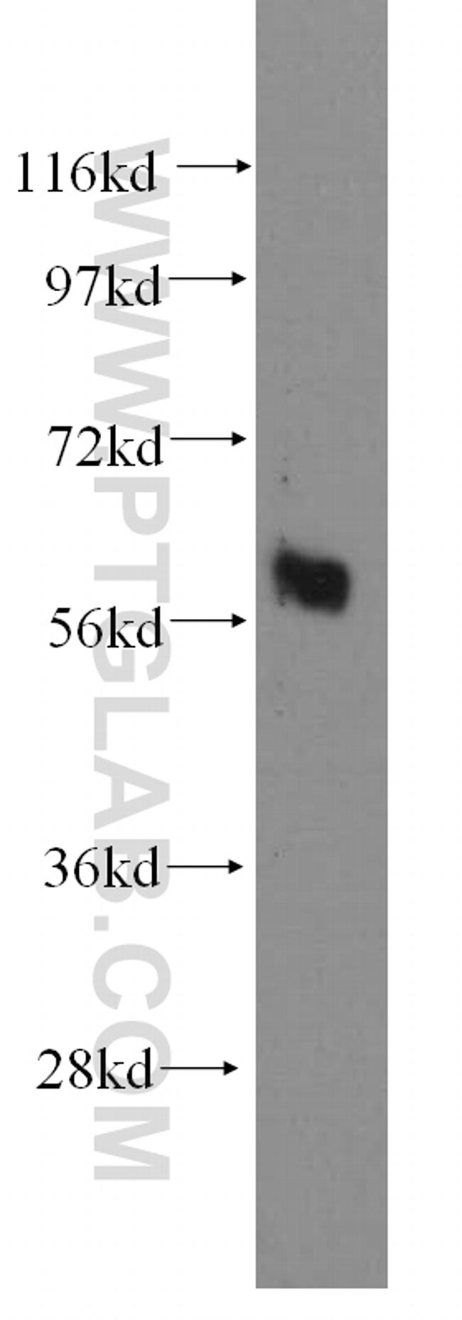 ARHGEF5 Antibody in Western Blot (WB)