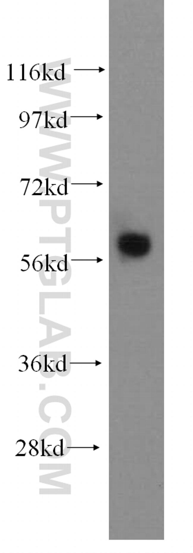 ARHGEF5 Antibody in Western Blot (WB)