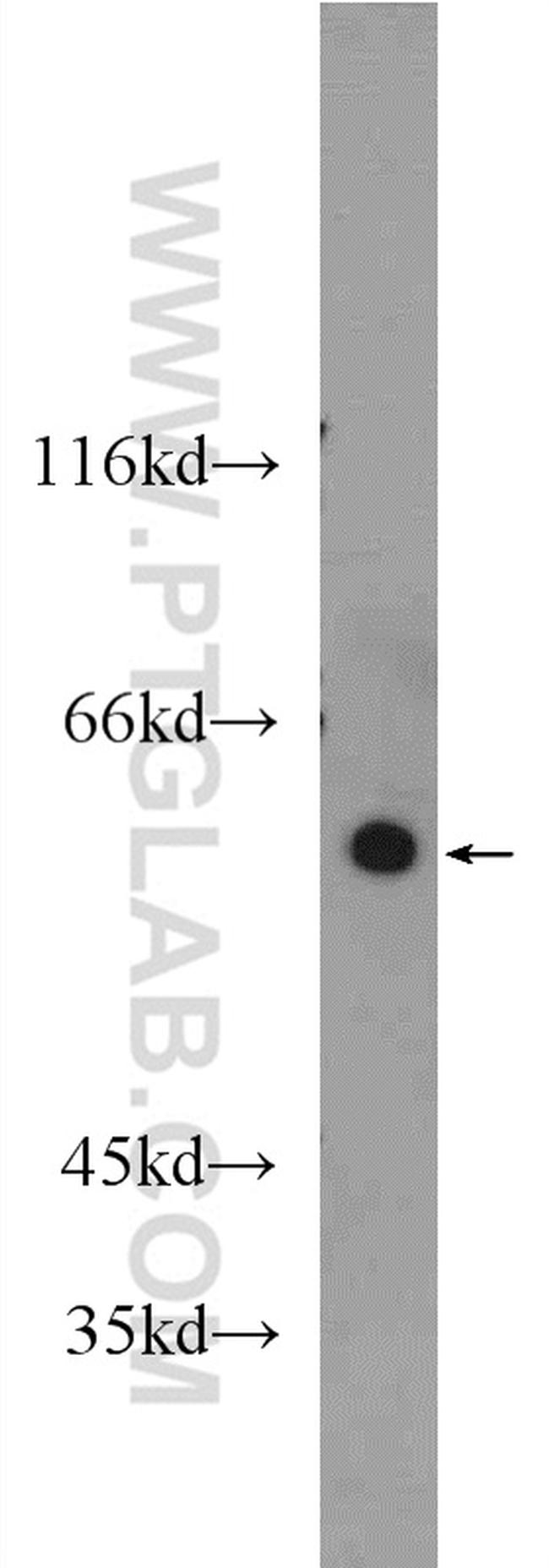 ARHGEF5 Antibody in Western Blot (WB)