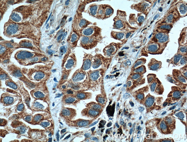 ARHGEF5 Antibody in Immunohistochemistry (Paraffin) (IHC (P))