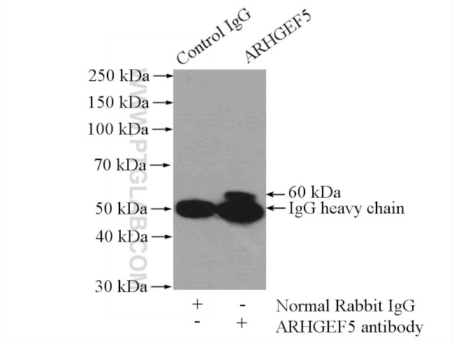 ARHGEF5 Antibody in Immunoprecipitation (IP)