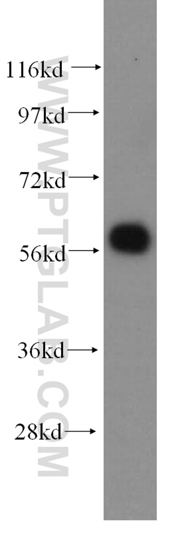 ARHGEF5 Antibody in Western Blot (WB)