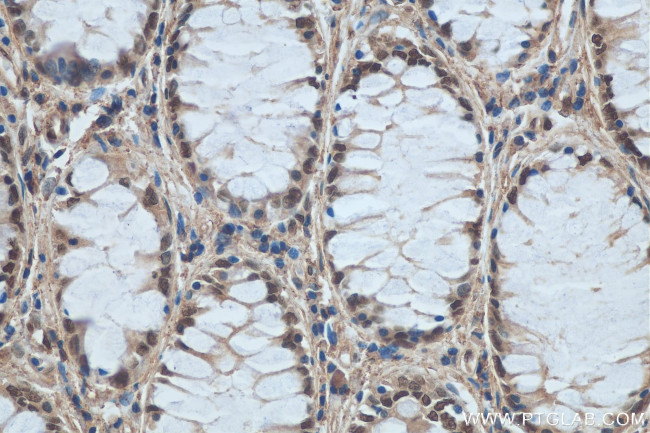 DDB1 Antibody in Immunohistochemistry (Paraffin) (IHC (P))