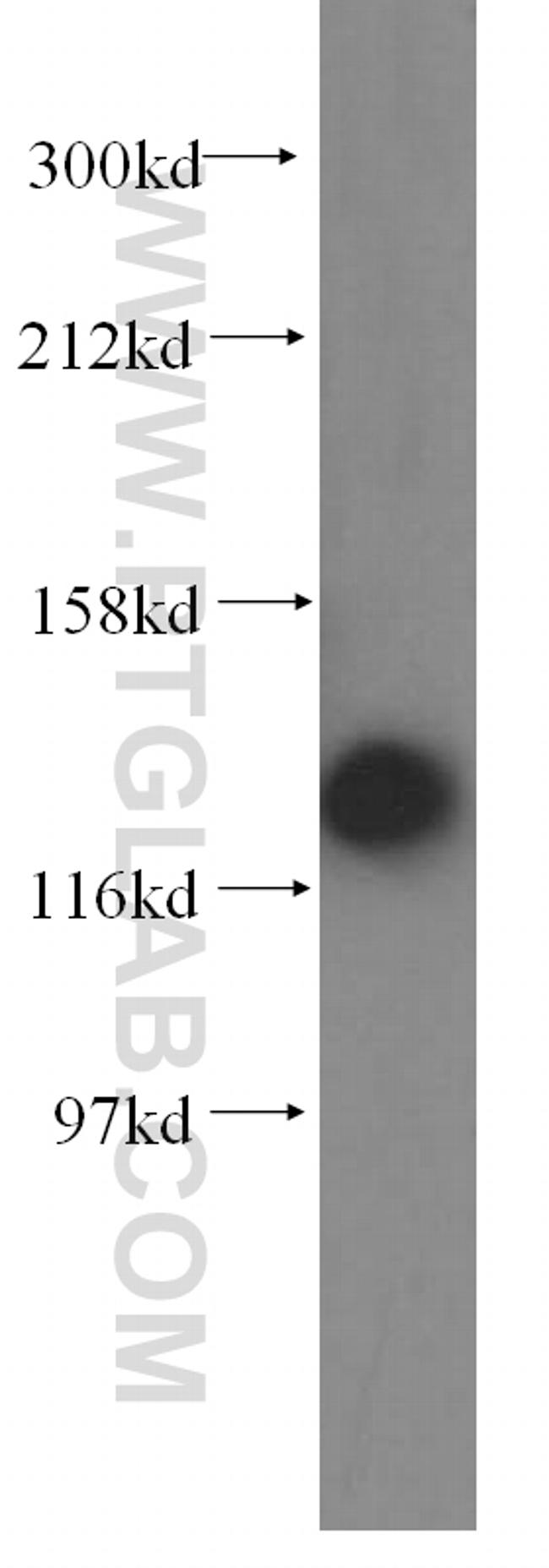 DDB1 Antibody in Western Blot (WB)