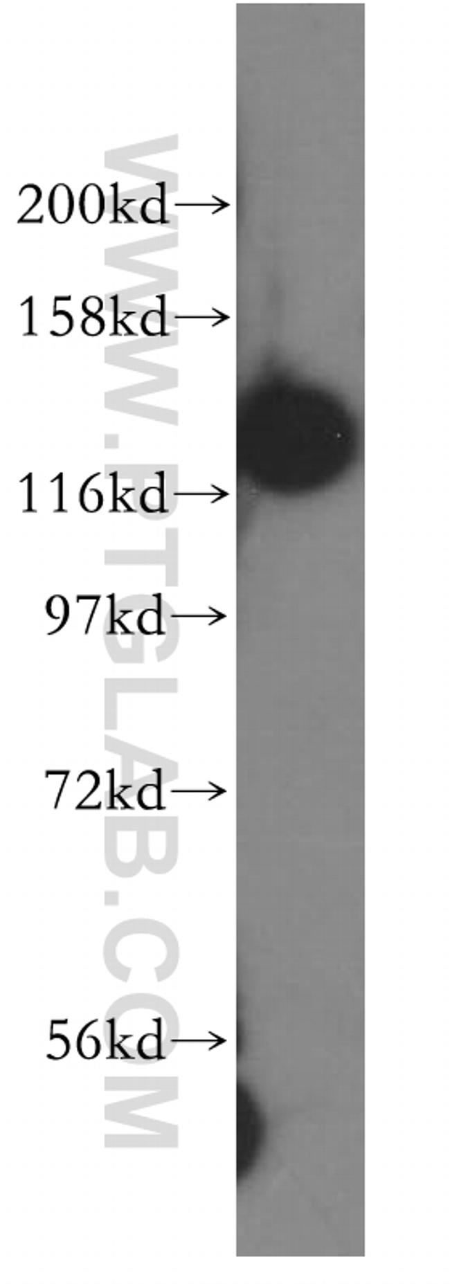 DDB1 Antibody in Western Blot (WB)